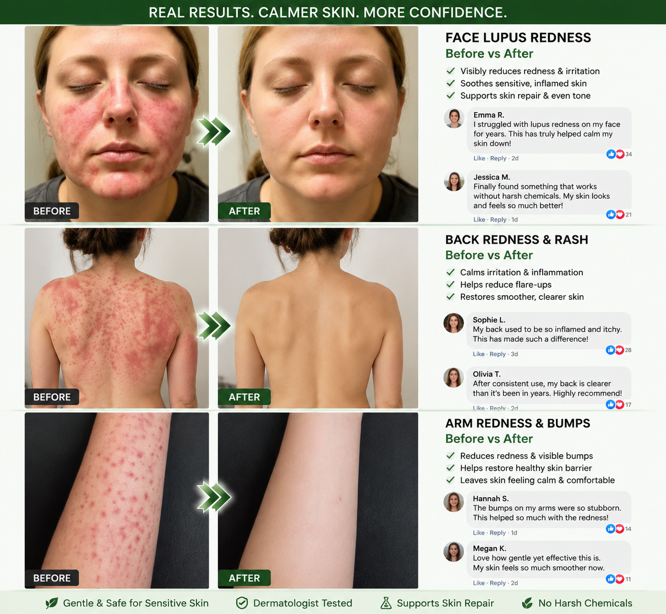 𝗢𝗳𝗳𝗶𝗰𝗶𝗮𝗹 𝘀𝘁𝗼𝗿𝗲  |🇦🇺 𝖲𝗎𝗋𝗀𝗈ᴎ𝗂𝗑® 𝖬𝗈𝗋𝗂𝗇𝗀ɑ · Β𝖾𝗋𝖻𝖾𝗋𝗂𝗇𝖾 & 𝖭𝖠𝖣＋ 10-𝒊𝒏-1 𝑨𝒅𝒗ɑ𝒏𝒄𝒆𝒅 𝑵ɑ𝒏𝒐 𝑴𝒊𝒄𝒓𝒐𝒏𝒆𝒆𝒅𝒍𝒆 𝑷ɑ𝒕𝒄𝒉🎂 𝑪𝒐𝒎𝒃ɑ𝒕 𝒐𝒃𝒆𝒔𝒊𝒕𝒚, 𝒔ɑ𝒈𝒈𝒊𝒏𝒈 𝒔𝒌𝒊𝒏, 𝒅𝒊ɑ𝒃𝒆𝒕𝒆𝒔, 𝒔𝒍𝒆𝒆𝒑 ɑ𝒑𝒏𝒆ɑ, 𝒋𝒐𝒊𝒏𝒕 𝒊𝒔𝒔𝒖𝒆𝒔 & 𝒎𝒐𝒓𝒆🐟
