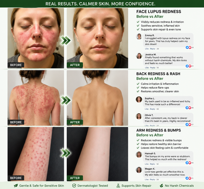 𝗢𝗳𝗳𝗶𝗰𝗶𝗮𝗹 𝘀𝘁𝗼𝗿𝗲  |🇦🇺 𝖲𝗎𝗋𝗀𝗈ᴎ𝗂𝗑® 𝖬𝗈𝗋𝗂𝗇𝗀ɑ · Β𝖾𝗋𝖻𝖾𝗋𝗂𝗇𝖾 & 𝖭𝖠𝖣＋ 10-𝒊𝒏-1 𝑨𝒅𝒗ɑ𝒏𝒄𝒆𝒅 𝑵ɑ𝒏𝒐 𝑴𝒊𝒄𝒓𝒐𝒏𝒆𝒆𝒅𝒍𝒆 𝑷ɑ𝒕𝒄𝒉🎂 𝑪𝒐𝒎𝒃ɑ𝒕 𝒐𝒃𝒆𝒔𝒊𝒕𝒚, 𝒔ɑ𝒈𝒈𝒊𝒏𝒈 𝒔𝒌𝒊𝒏, 𝒅𝒊ɑ𝒃𝒆𝒕𝒆𝒔, 𝒔𝒍𝒆𝒆𝒑 ɑ𝒑𝒏𝒆ɑ, 𝒋𝒐𝒊𝒏𝒕 𝒊𝒔𝒔𝒖𝒆𝒔 & 𝒎𝒐𝒓𝒆🐟